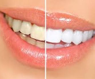 Revisiones bucales: Tratamientos de Dental Icaria, S.L.
