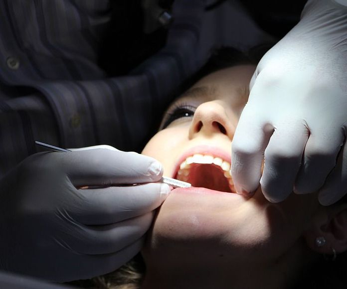Endodoncia: Servicios de Clínica Dental Doctora Cruz