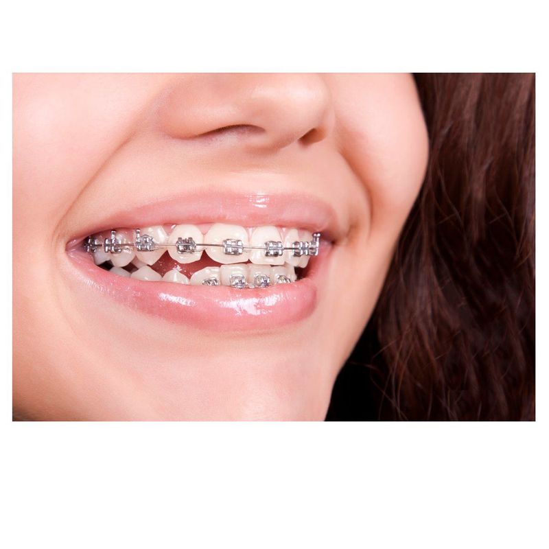 Ortodoncia dental