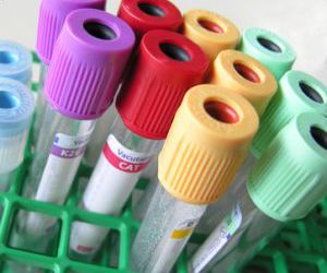 Blood tests with instant results